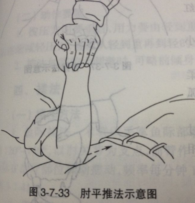 (3)肘平推法:术者屈肘,以肘尖(尺骨鹰嘴)